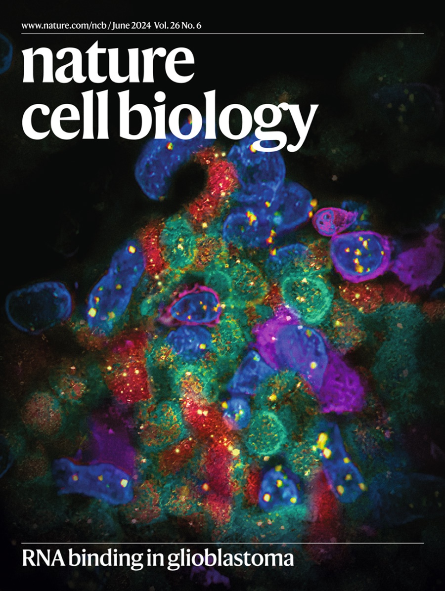 『Matéria de capa』Decifrando o microambiente tumoral: como as proteínas de ligação RNA-RNA revelam novos alvos para o tratamento do glioblastoma de tipo selvagem IDH!